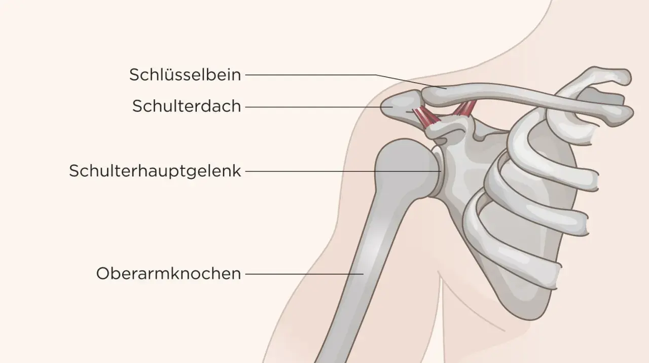 Anatomie der Schulter: Schlüsselbein, Schulterdach, Schulterhauptgelenk und Oberarmknochen. Mögliche Ursachen für Schulter Arm Syndrom.