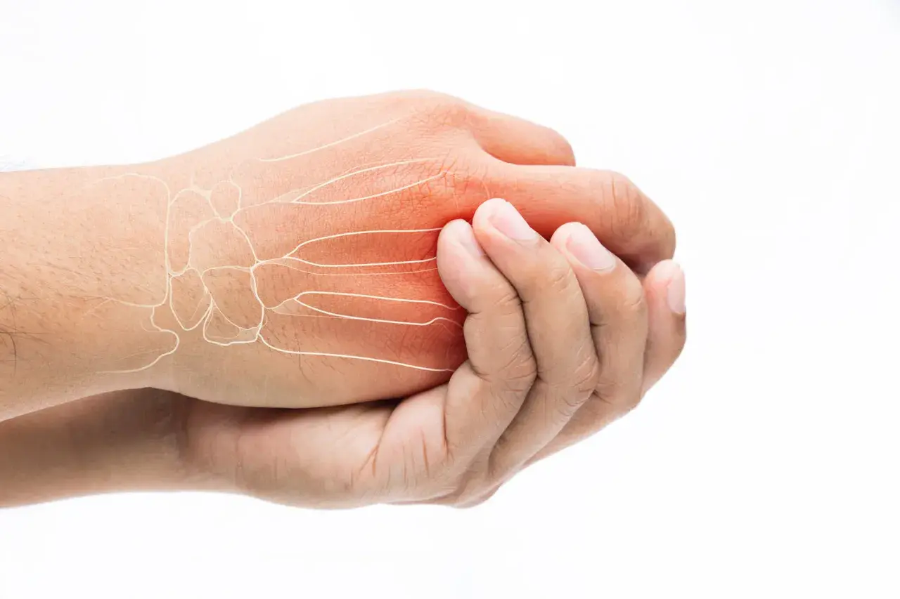 Schmerzende Hand mit Knochenstruktur und roter Entzündung. Ein Hoffnungsschimmer für eine Wunderwaffe gegen Arthrose Finger.