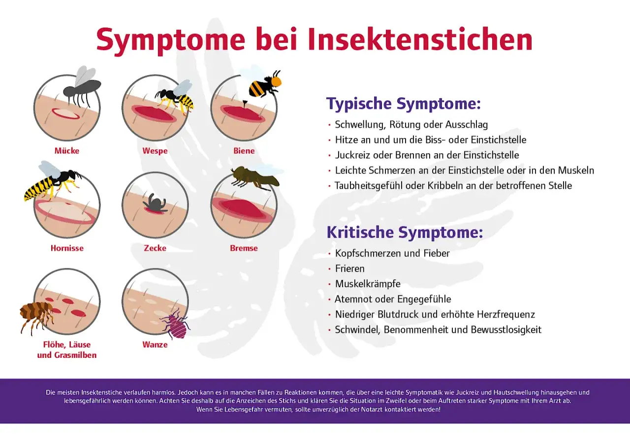 Illustrationen von M&uuml;cken-, Wespen-, Bienen-, Hornissen-, Zecken-, Bremsen-, Floh-, L&auml;use-, Grasmilben- und Wanzenstichen. Bei starken Symptomen nach einem Insektenstich wann zum Arzt?