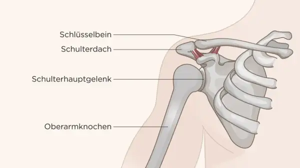 Anatomie der Schulter: Schlüsselbein, Schulterdach, Schulterhauptgelenk und Oberarmknochen. Mögliche Ursachen für Schulter Arm Syndrom.